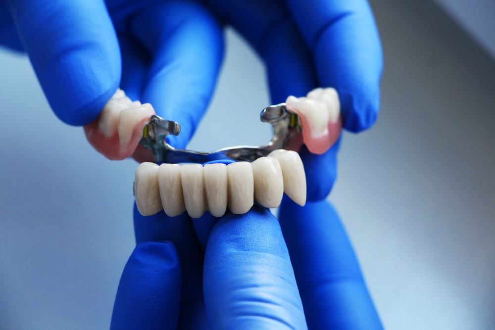 Dental Crowns and Bridges Frontenac, MO | Frontenac, MO Dental Care | John Martin Dental