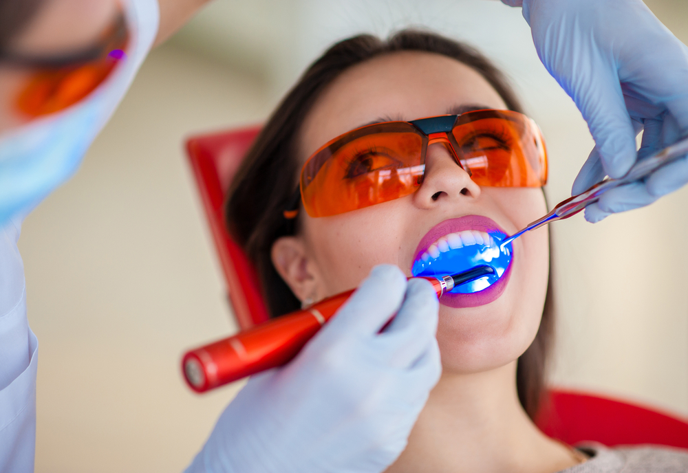 dental bonding services Maryland Heights, MO