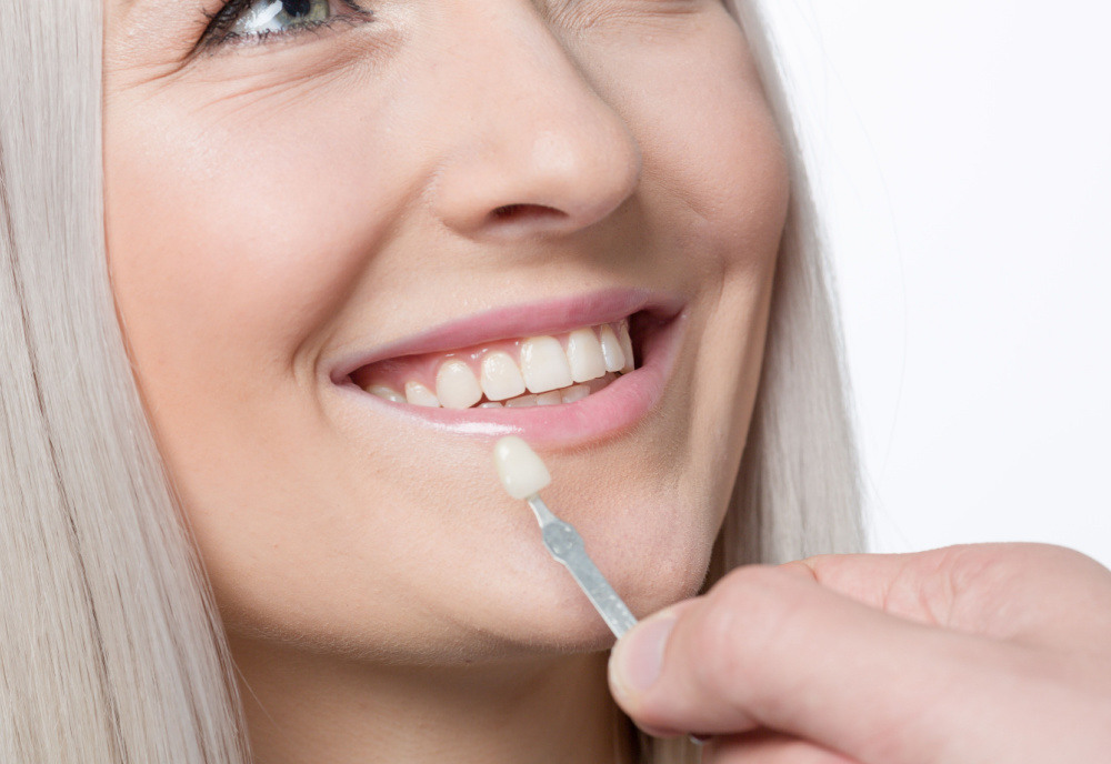 Dental Veneers Olivette, MO | Olivette, MO Porcelain Dental Veneers | Martin Dental & Associates